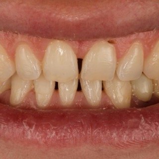 حالات قبل و بعد - 11