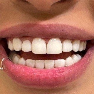 حالات قبل و بعد - 16