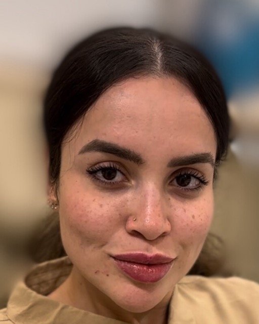 حالات قبل و بعد - 17