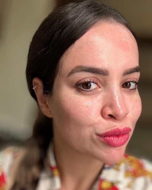 حالات قبل و بعد - 18