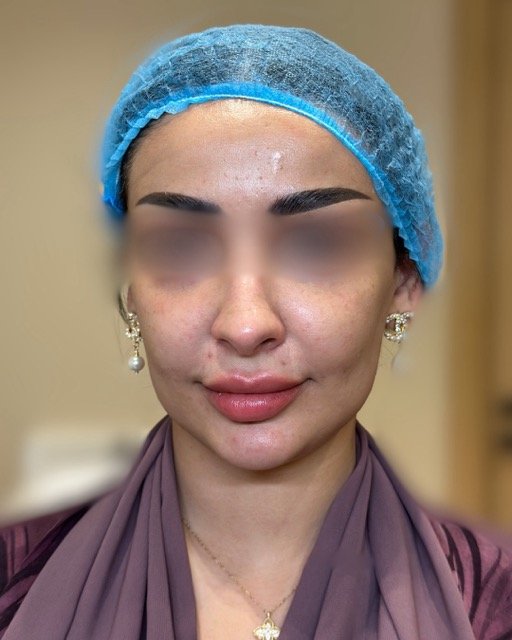 حالات قبل و بعد - 19