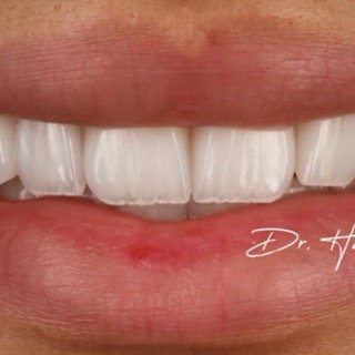 حالات قبل و بعد - 20