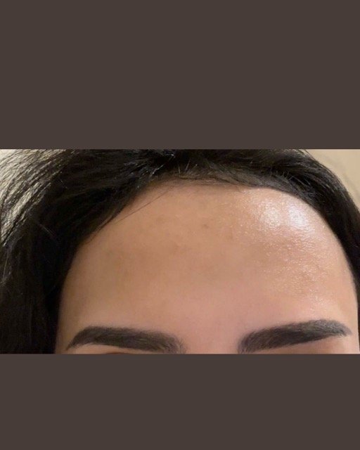 حالات قبل و بعد - 22