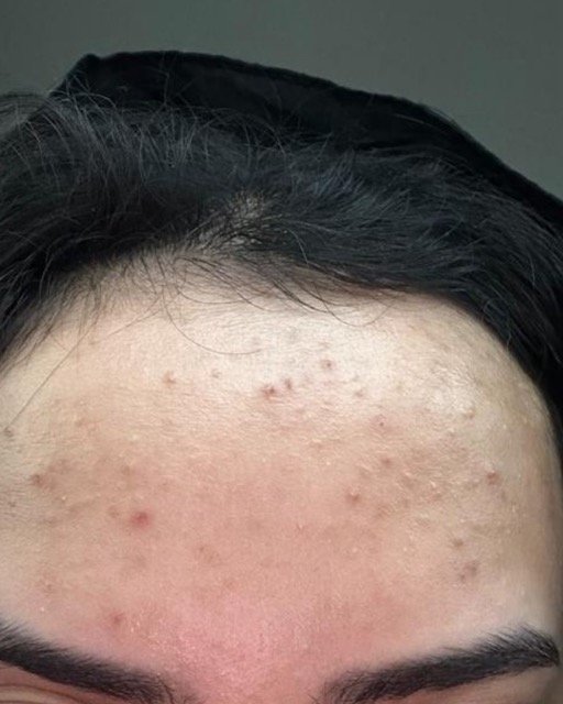 حالات قبل و بعد - 25