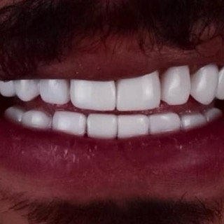 حالات قبل و بعد - 30