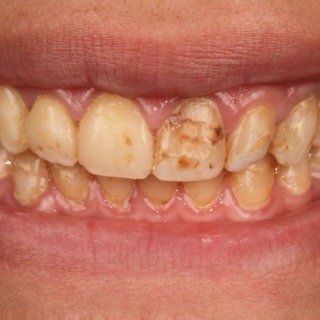 حالات قبل و بعد - 31