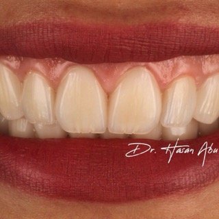 حالات قبل و بعد - 32