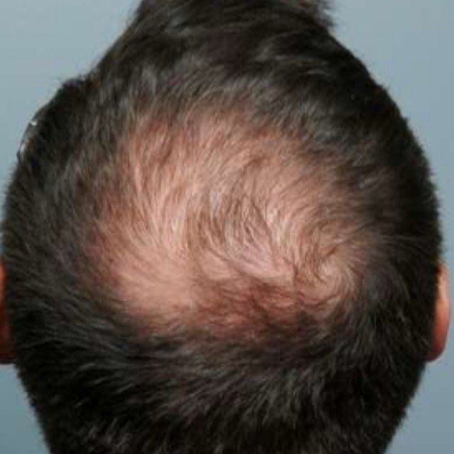 حالات قبل و بعد - 56