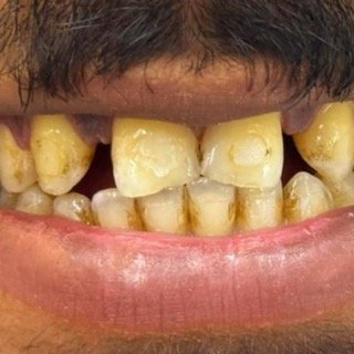 حالات قبل و بعد - 61