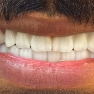 حالات قبل و بعد - 62