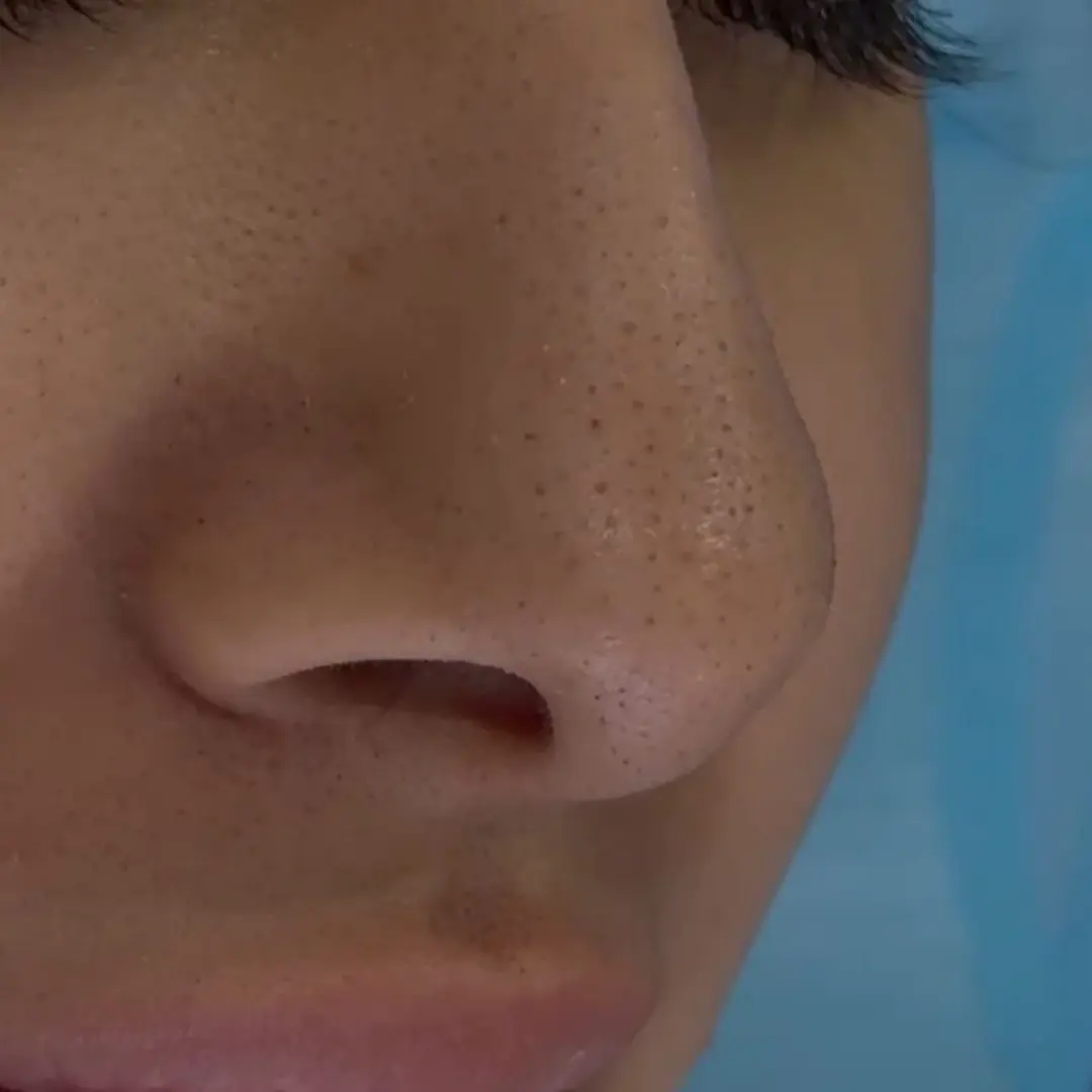 هايدرافيشيل في لوسيرا 1 قبل