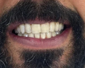 عيادات تنظيف اسنان