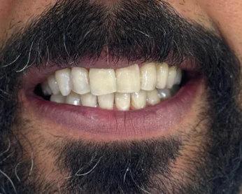 عيادات تنظيف اسنان