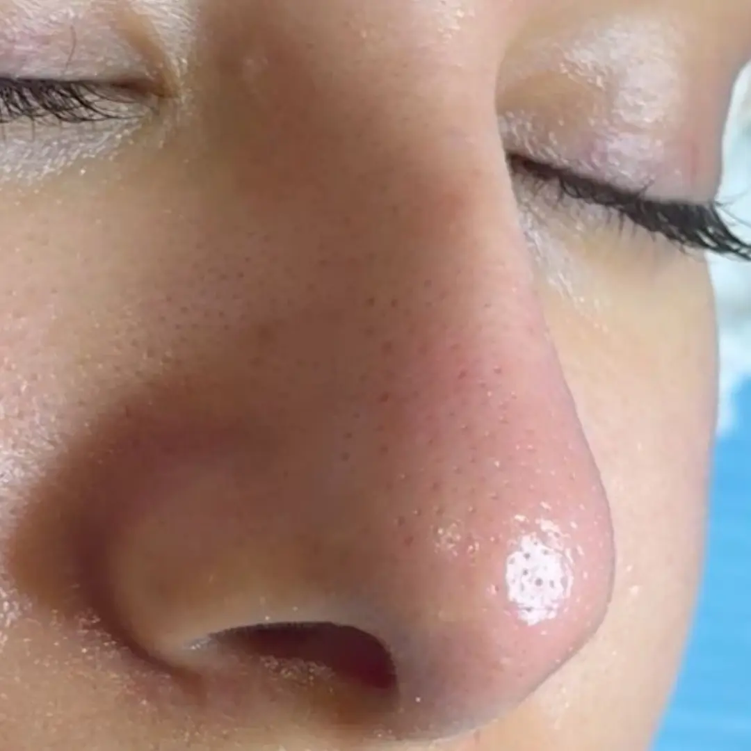 هايدرافيشيل-في-لوسيرا-1-بعد