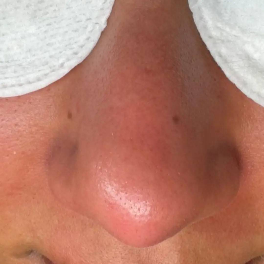 هايدرافيشيل-في-لوسيرا-3-بعد